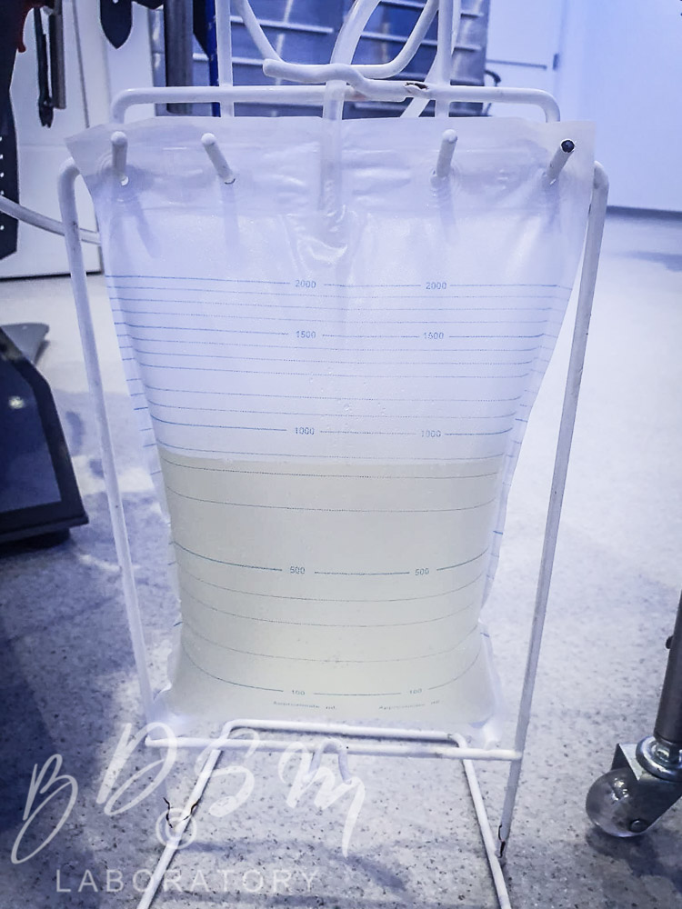 A medical colonics bag half filled with liquid